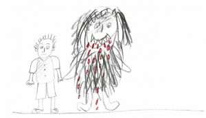 Drawing of a boy and his migraine represented by a hairy person
