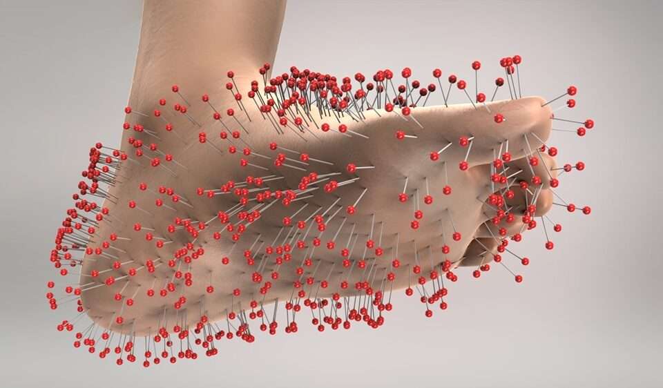 A foot with lot's of red headed needles in it